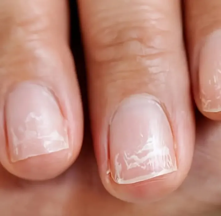 Nail Hardener SOS Damaged Nails